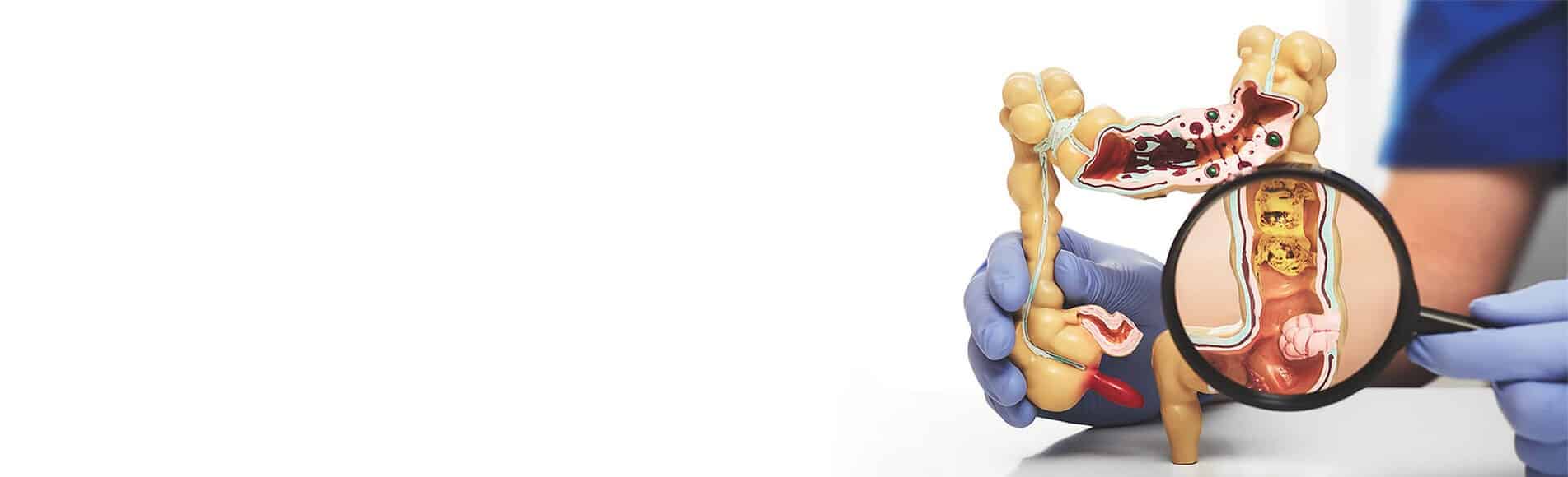 Best fistula surgeons in Pakistan providing advanced care