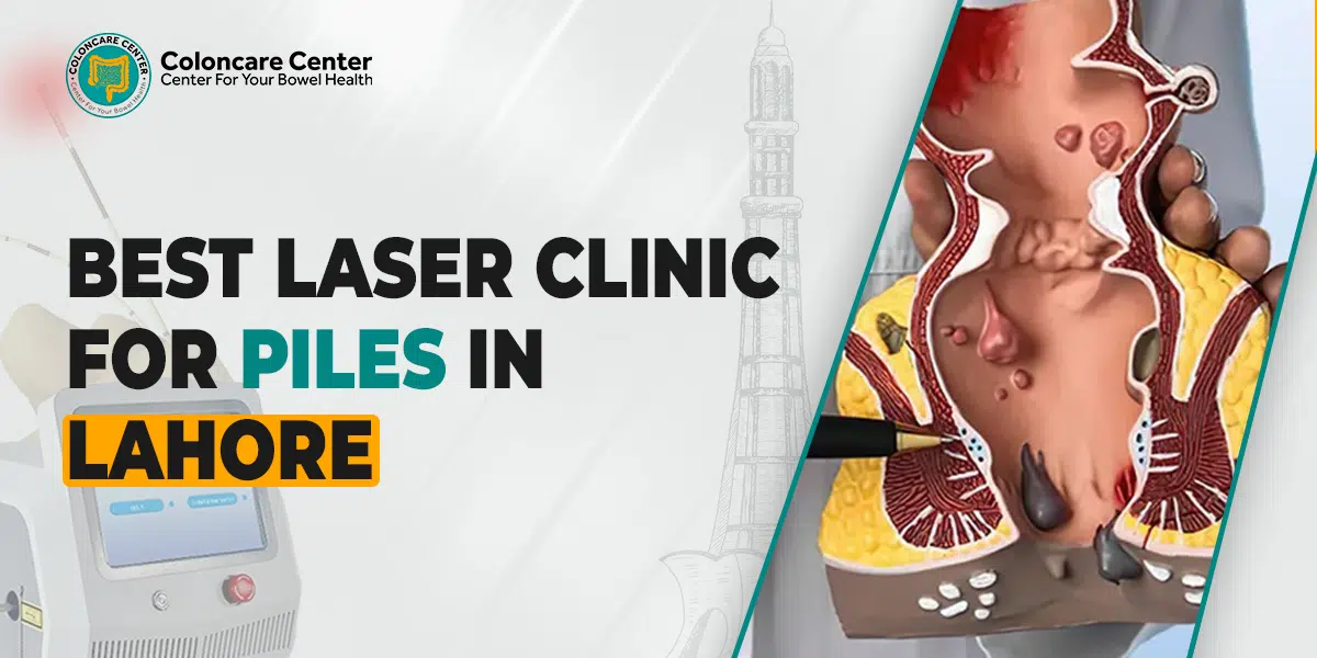 The Best Laser Clinic for piles In Lahore