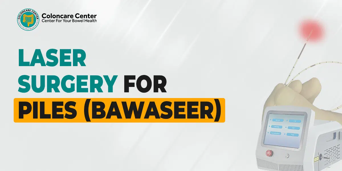 Best Professional Laser Surgery for Piles (Bawaseer) | Colon Care Center